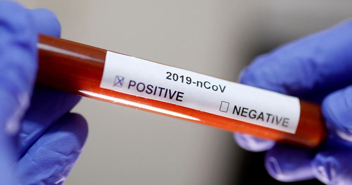 করোনা শনাক্তের হার বেড়ে ৭.৩৫ শতাংশ